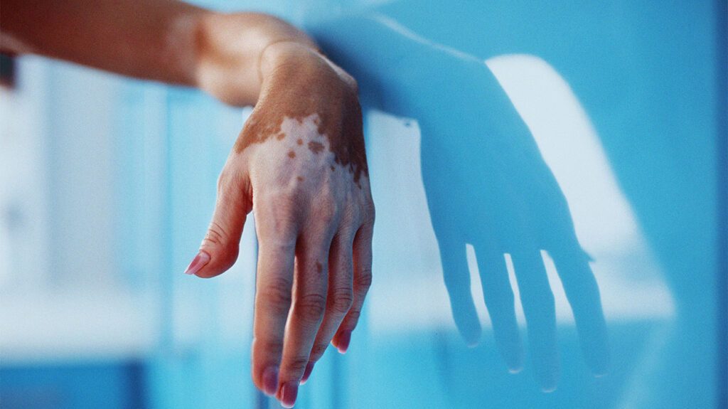 Why More Skin Illness You Are Facing